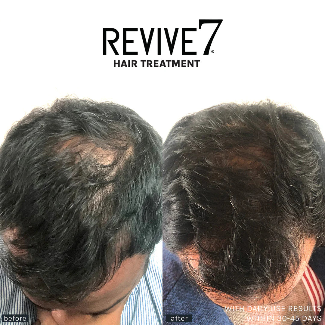 Revitalizing Hair Oil Treatment